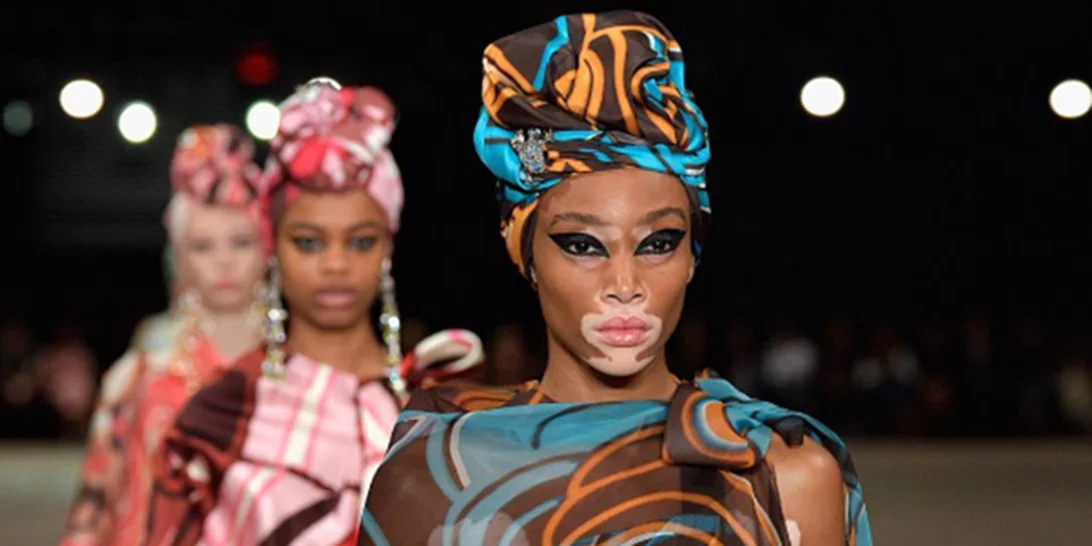 Winnie Harlow: Κι όμως δεν ήθελε να γίνει μοντέλο!