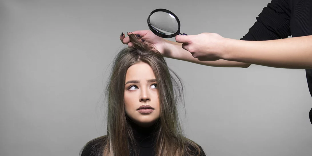 Πιτυρίδα: Μην την βλέπεις σαν εχθρό, μάθε πώς θα την αντιμετωπίσεις αποτελεσματικά