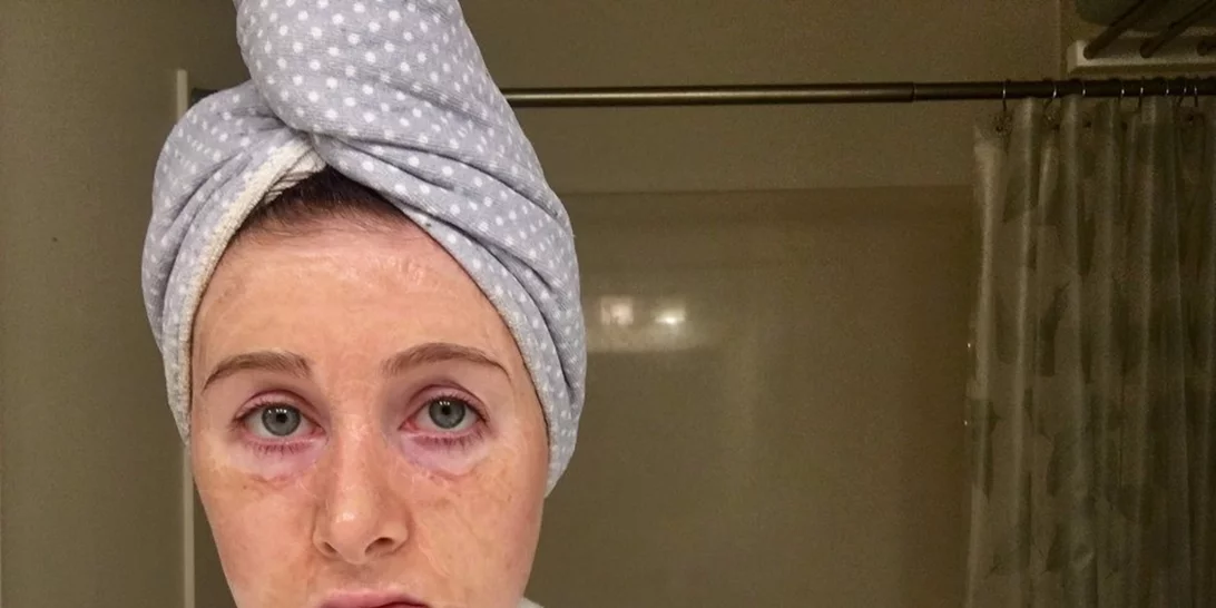 Hanacure: Η μάσκα προσώπου που σε μεταμορφώνει σε γιαγιά πριν σου χαρίσει τέλειο νεανικό δέρμα!