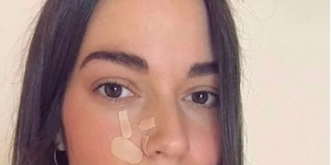 Ισμήνη Νταφοπούλου: Πιο όμορφη από ποτέ μετά τον σοβαρό τραυματισμό στο πρόσωπο!