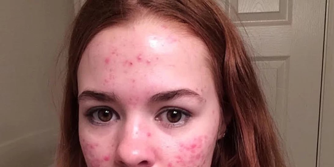 Φωτογράφιζε την ακμή της και έγινε viral!