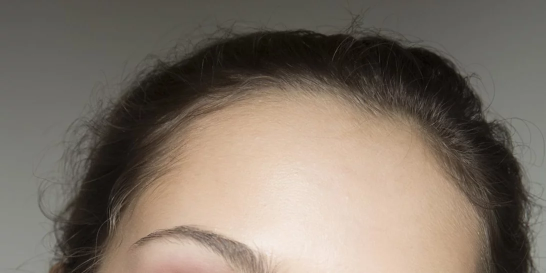 Σκασμένα χείλη και ακόμα δεν μπήκε ο χειμώνας; Μην το επιτρέψεις να συμβεί!