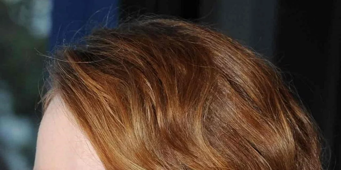 Emma Stone | H αγαπημένη μας κοκκινομάλλα έβαψε τα μαλλιά της