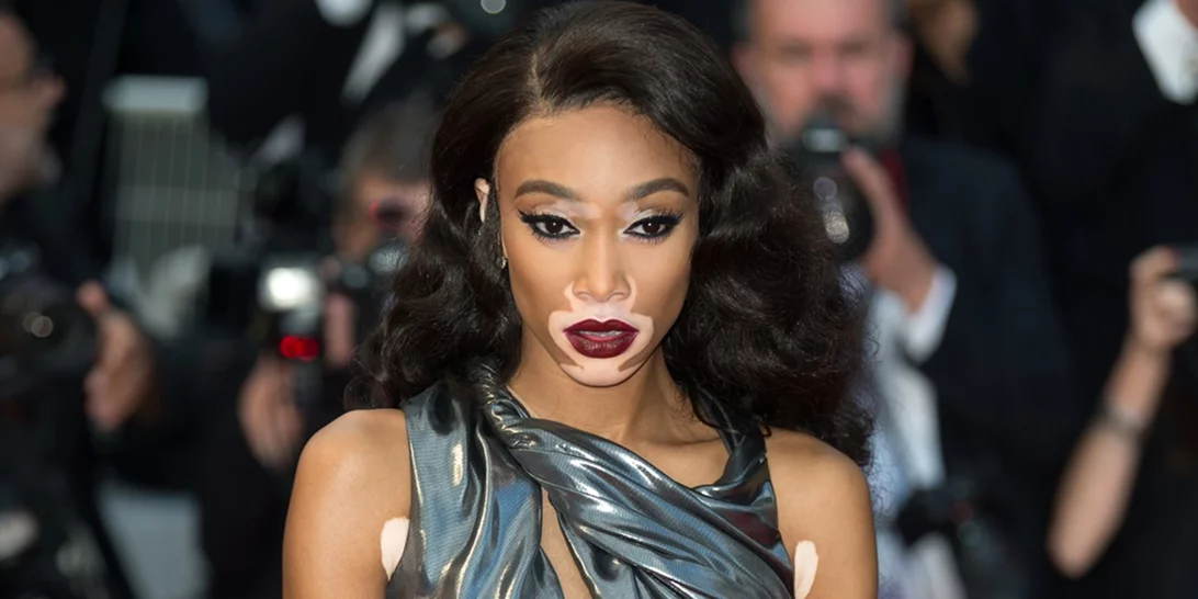 Winnie Harlow | Με εντυπωσιακή ασημένια τουαλέτα στις Κάννες!