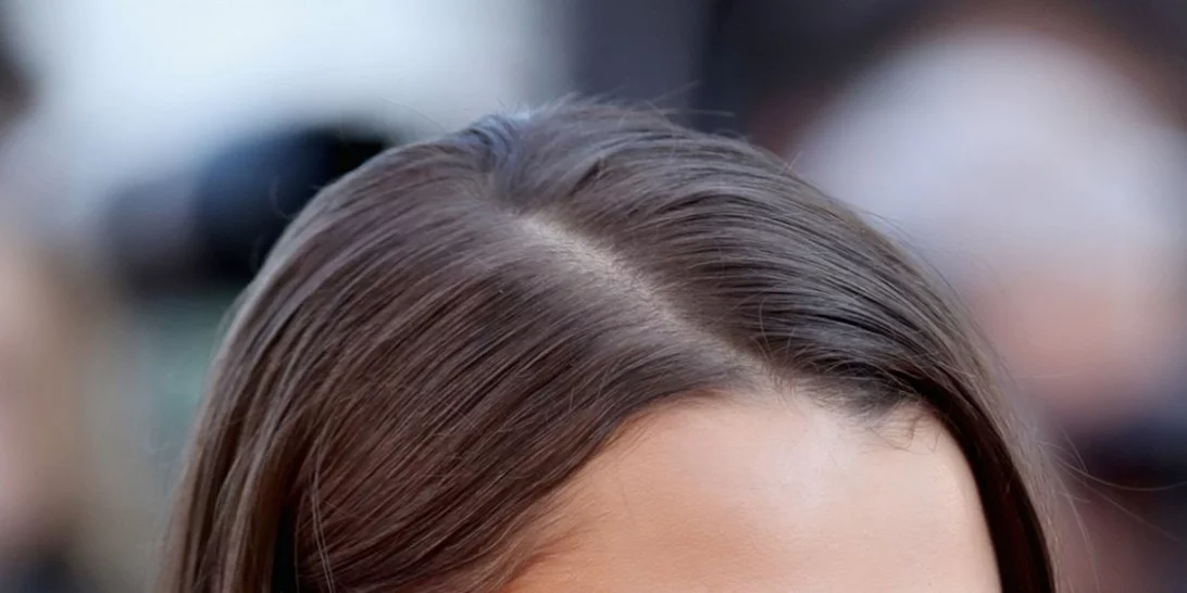 Bella Hadid | Σοκ έχει προκαλέσει η αποστεωμένη εικόνα της!