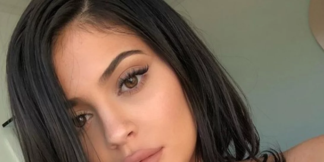 Kylie Jenner | Αυτός είναι ο λόγος που αποφάσισε να αφαιρέσει τα εμφυτεύματα χειλιών