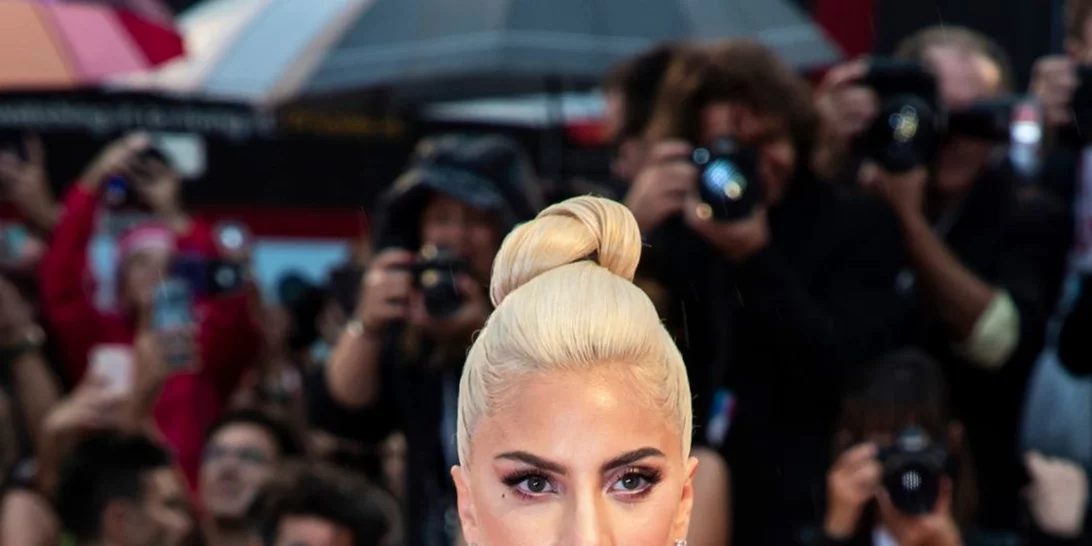 Lady Gaga | Η πλαστική επέμβαση που της ζήτησαν να κάνει στην αρχή της καριέρας της