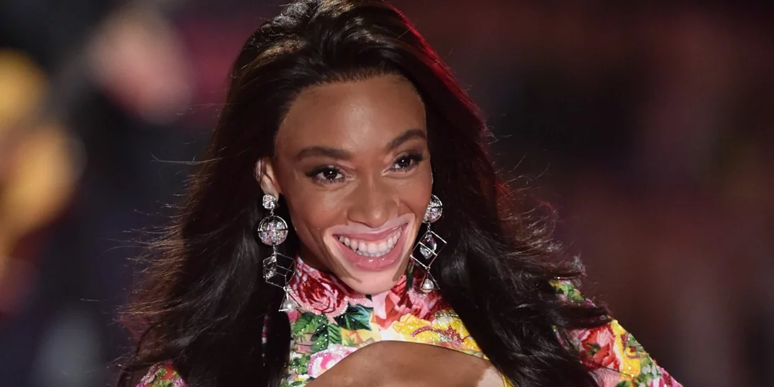 Winnie Harlow | Έγραψε ιστορία με την εμφάνιση της στο #VSshow