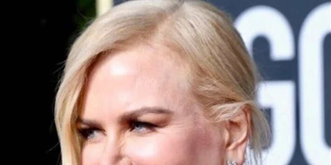 Χρυσές Σφαίρες 2019: Γιατί τα μαλλιά της Nicole Kidman προκάλεσαν πανικό στα social media;
