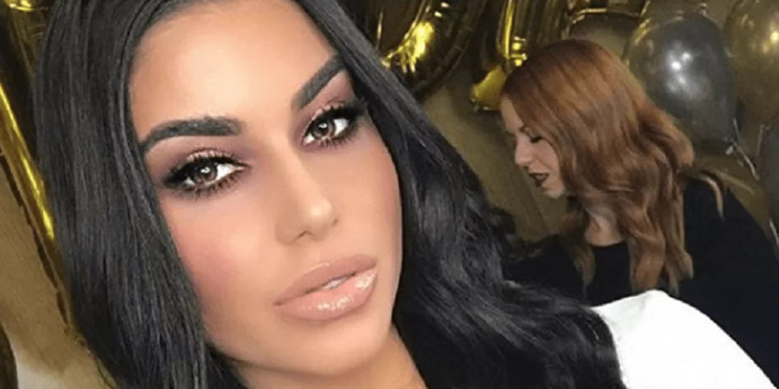 Η Ιωάννα Μπέλλα αποφάσισε να αφαιρέσει το υαλουρονικό από τα χείλη της | Δες πλάνα