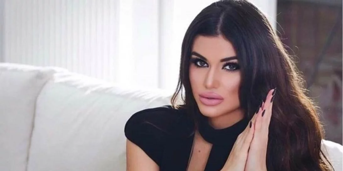 Ιωάννα Μπέλλα | Δες την πριν και μετά την αισθητική παρέμβαση που έκανε στα χείλη της!