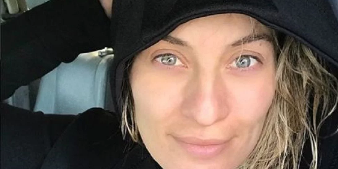 Ελεονώρα Μελέτη | Δείχνει τις μελανιές στο σώμα της και περνά ένα σημαντικό μήνυμα