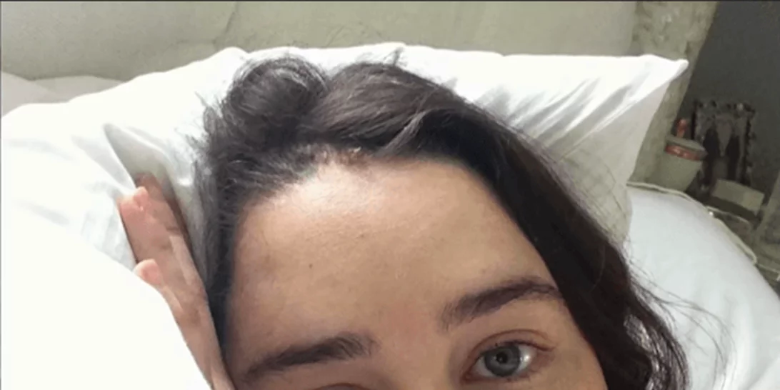 Emilia Clarke | Δημοσίευσε σπάνιες φωτογραφίες από τις εγχειρήσεις της