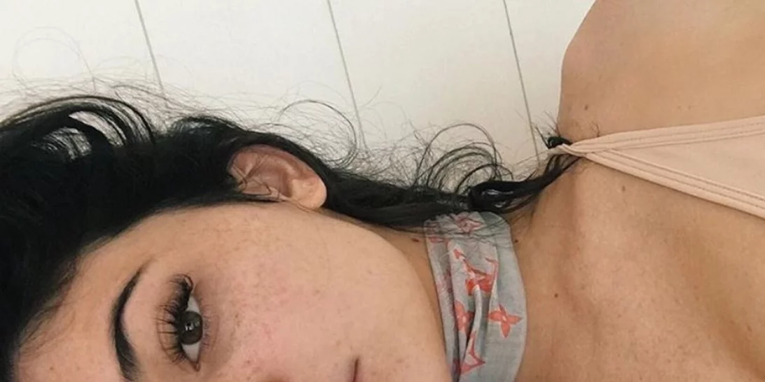 Πώς ήταν η επιδερμίδα της Kylie Jenner πριν 3 χρόνια και πώς σήμερα; Όλες οι φωτογραφίες της χωρίς μακιγιάζ
