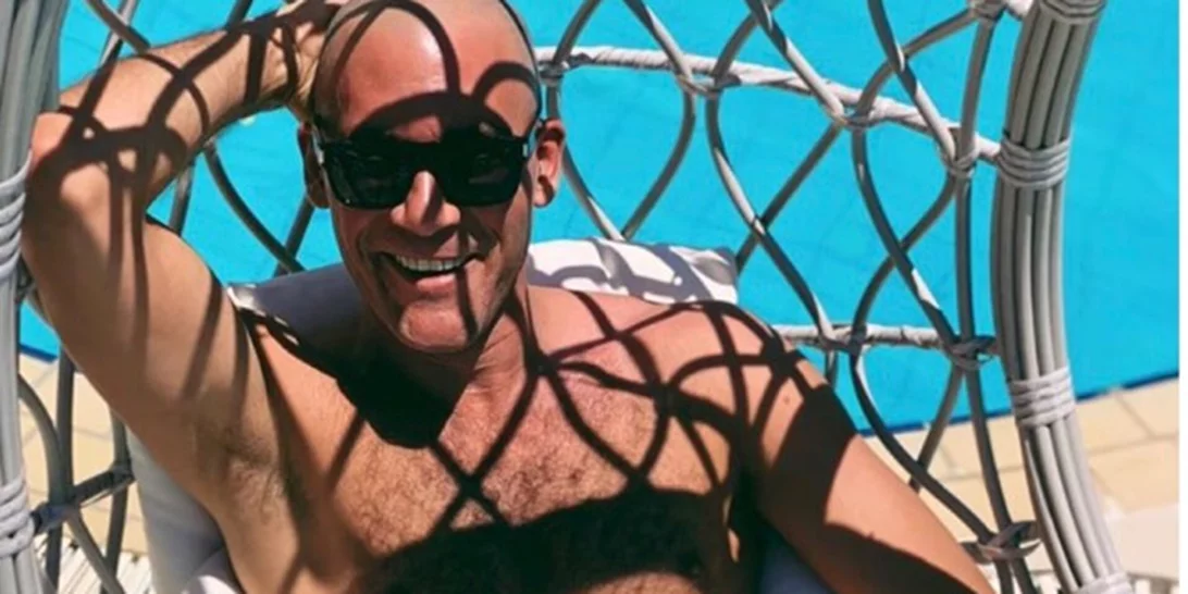 Αντίνοος Αλμπάνης | Η δημόσια αποκάλυψη για τις χημειοθεραπείες που κάνει