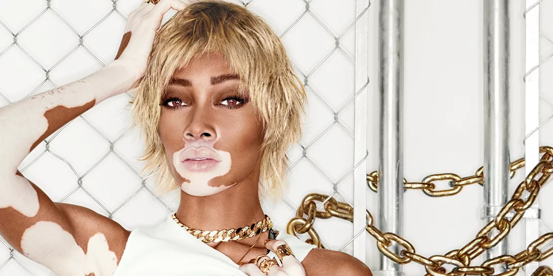 Η νέα συλλογή παπουτσιών Winnie Harlow x Steve Madden αναδεικνύει τη δυναμικότητα κάθε γυναίκας