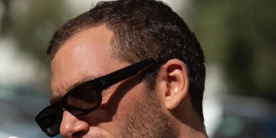 Αντίνοος Aλμπάνης | Η φωτογραφία που δημοσίευσε μετά τη χημειοθεραπεία και το αισιόδοξο μήνυμα