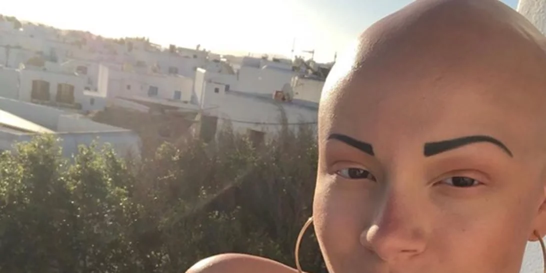 GNTM - Λυδία Κατσανικάκη | Ποζάρει αγνώριστη με καρέ μαλλιά