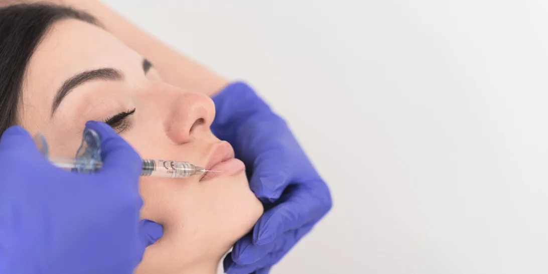 Filler Fatigue | Η παρενέργεια του υαλουρονικού στο πρόσωπο