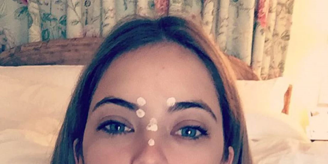 Δεν είσαι μόνη σου! 10 celebrities δείχνουν τα σπυράκια στο πρόσωπό τους