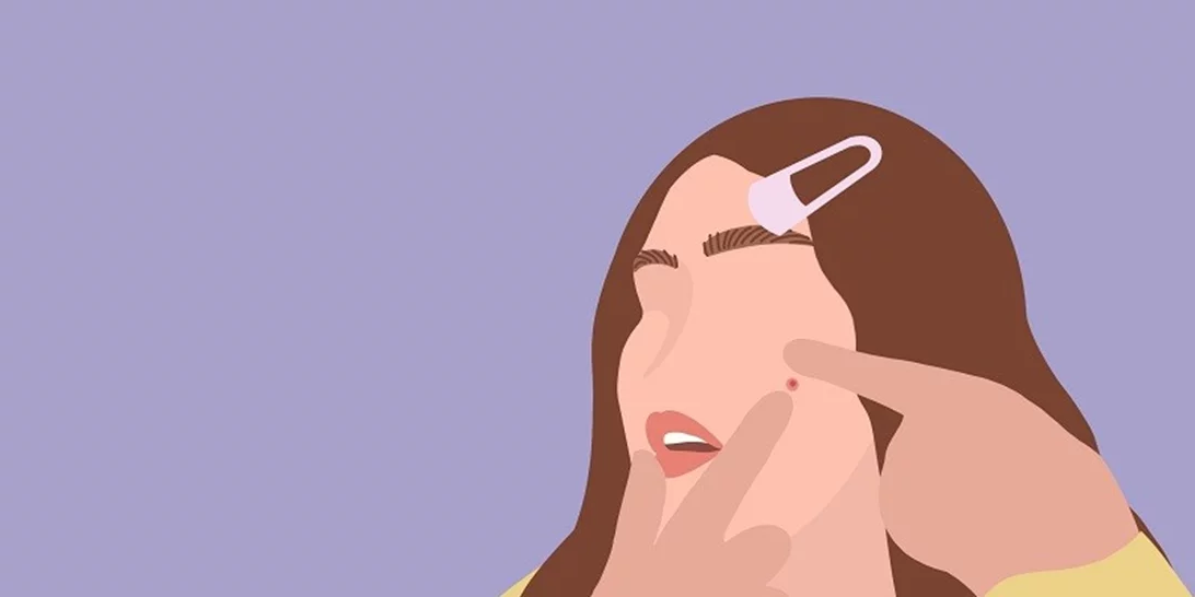 Δεν άντεξες και έσπασες το σπυράκι. Και τώρα τι πρέπει να κάνεις για να μη μολυνθεί και πρηστεί;