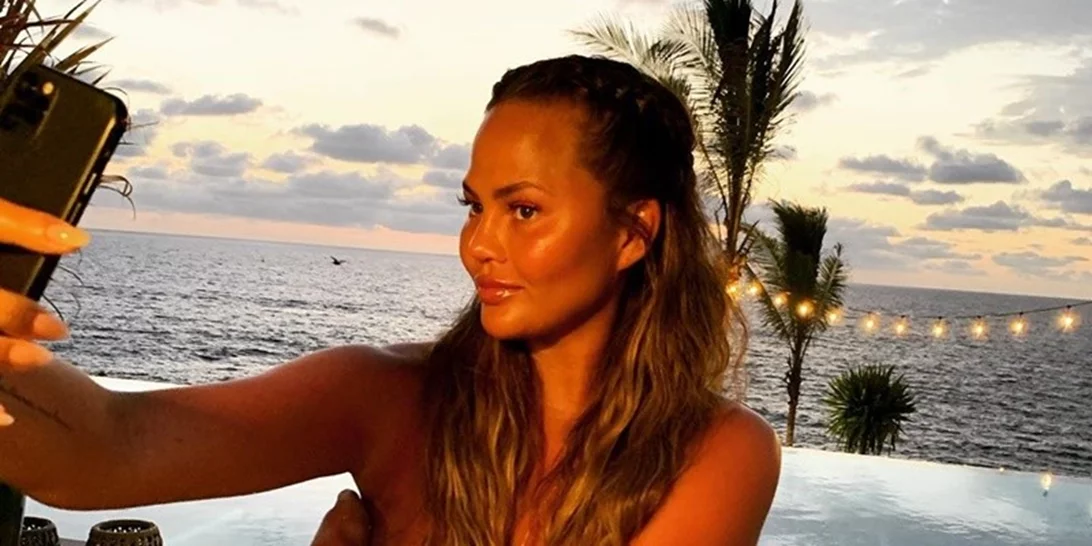 Chrissy Teigen | Δείχνει τις ουλές στο στήθος της για όσους δεν πιστεύουν ότι έκανε αφαίρεση