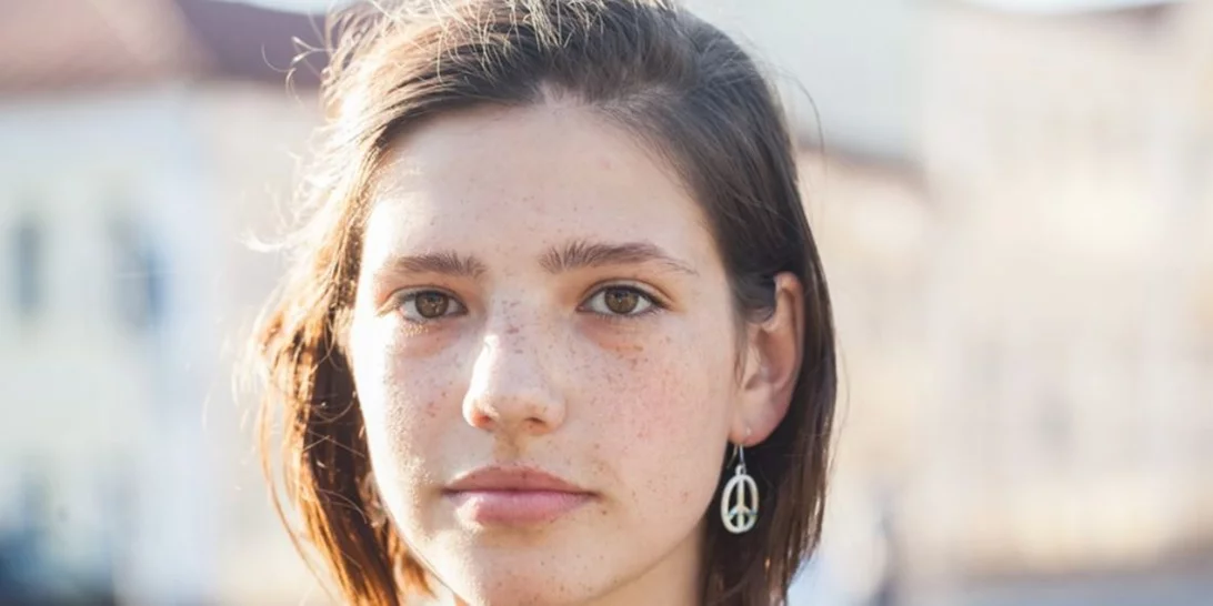 Καταπολέμησε την ακμή με "όπλο" τη διατροφή σου