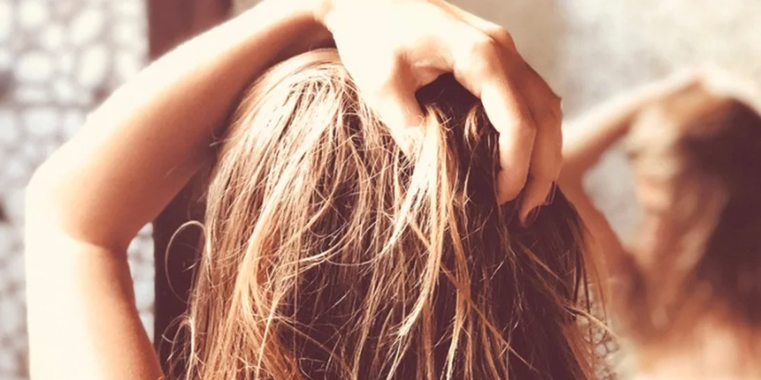 Έχω πιτυρίδα, τι να κάνω; Όσα συστήνει ο δερματολόγος για την αντιμετώπισή της