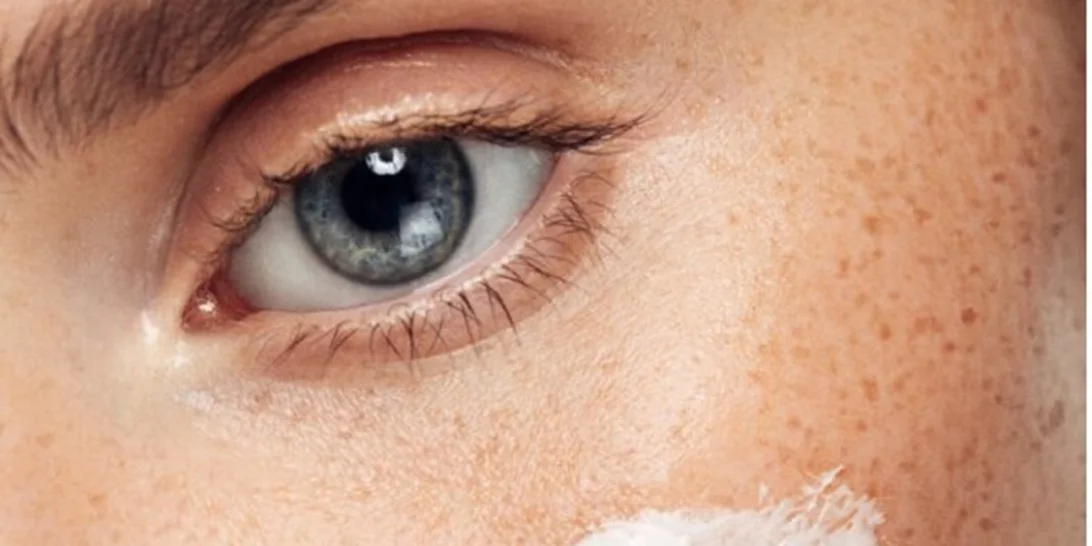 Το δέρμα σου όταν πιάσεις τα 30: Αυτά συστήνει η δερματολόγος τώρα