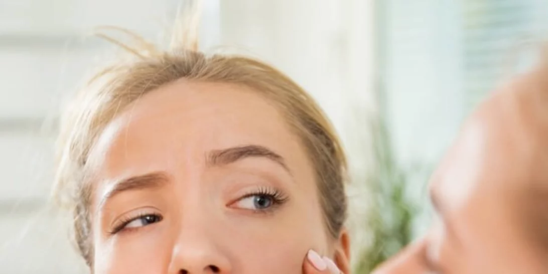 Ροδόχρους νόσος: Πώς θα απαλλαγείς από τα σπυράκια και τις κοκκινίλες;