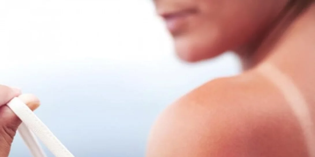 5 τροφές που νικούν κυστίτιδα, έρπη, ημικρανίες, εγκαύματα και αλλεργική ρινίτιδα