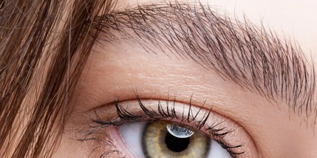 3 περίεργοι λόγοι που έχεις μαύρους κύκλους