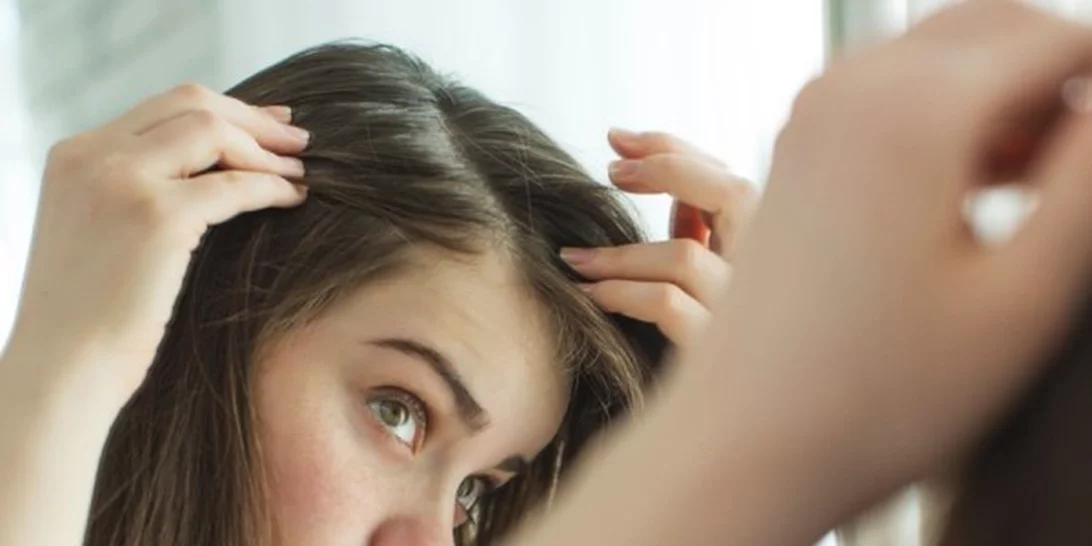 Πόσο συχνά να λούζω τα μαλλιά με πιτυρίδα; O μύθος που πρέπει να ξέρεις!