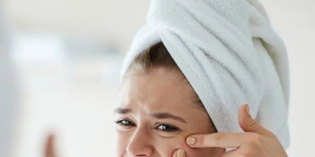 Aυτές είναι οι 14 καλύτερες τροφές κατά της ακμής