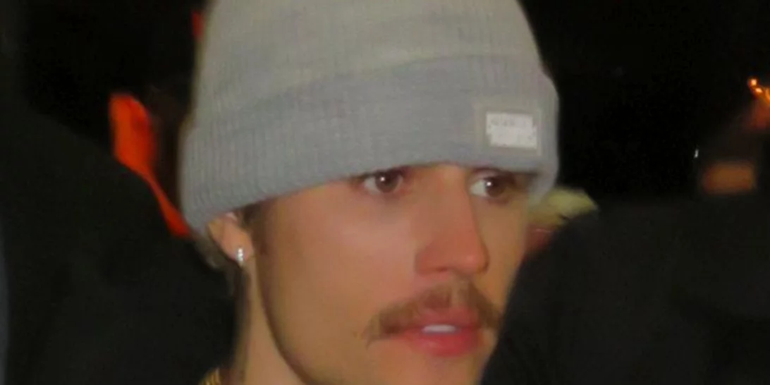 Νεαρή Βρετανίδα που πάσχει από το ίδιο σύνδρομο με τον Justin Bieber αφηγείται πώς ένιωσε βλέποντας το βίντεο του σταρ