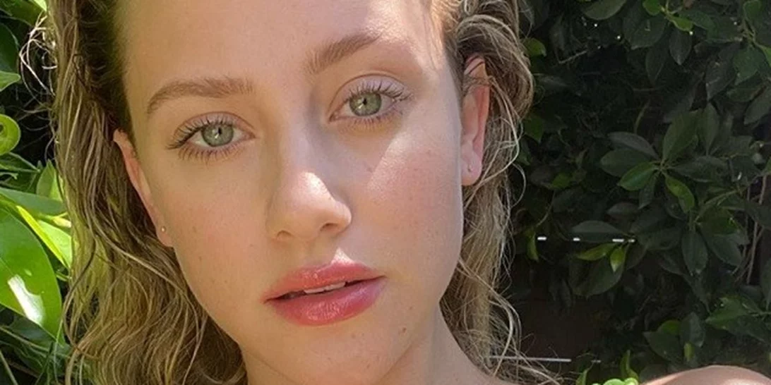 Διεσταλμένοι πόροι; Οι πιο εύκολοι τρόπο να βελτιώσεις την όψη τους