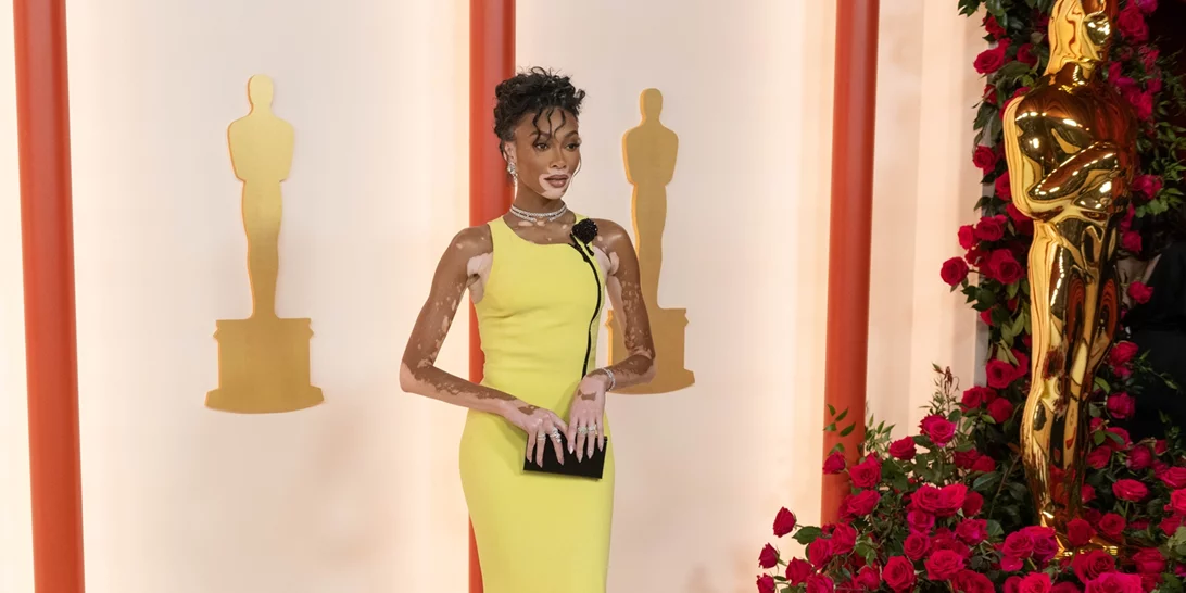 Η Winnie Harlow ποζάρει στη νέα καμπάνια του brand της με Celia Kritharioti μαγιό