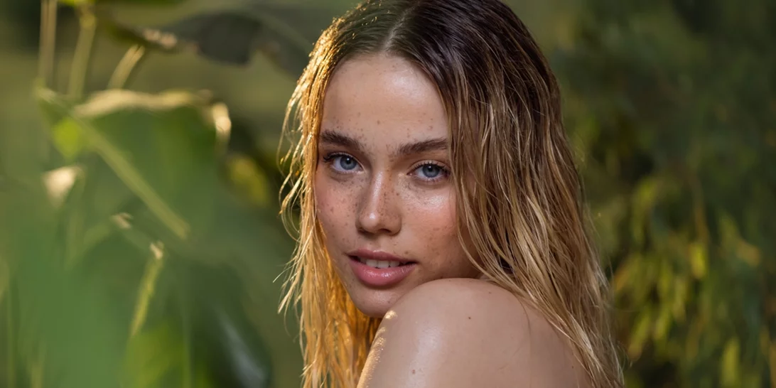 Όλοι οι λόγοι για τους οποίους μπορεί να εμφανίζεις ακμή / σπυράκια μετά τις διακοπές και τι να κάνεις