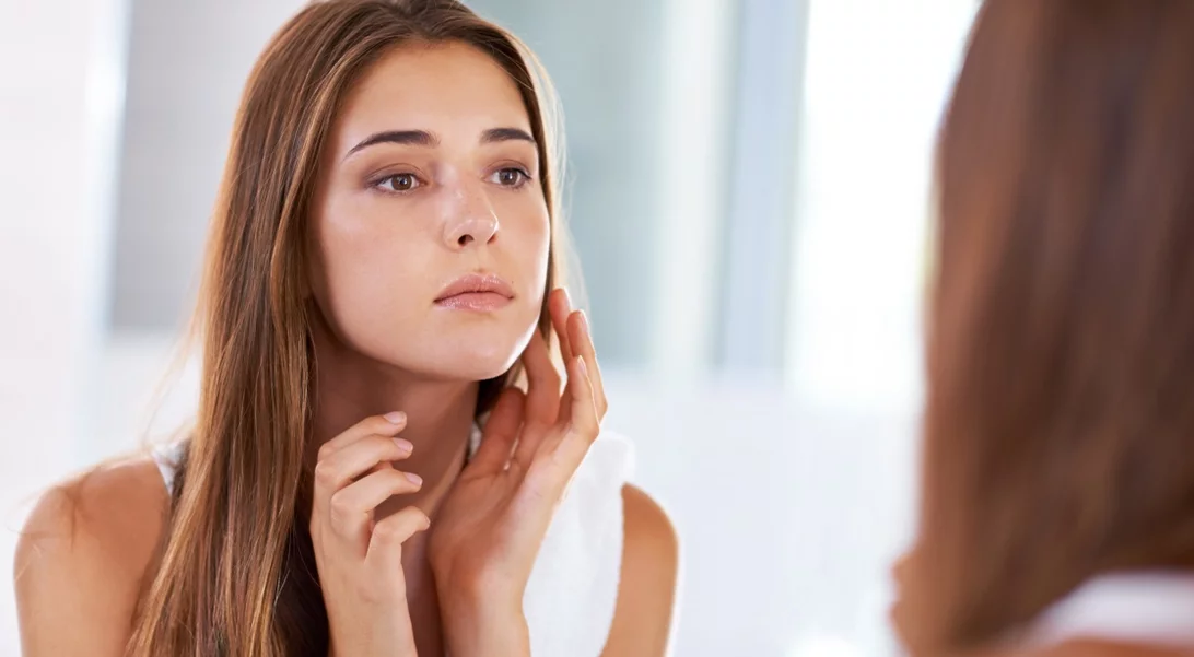 Σύνδρομο πολυκυστικών ωοθηκών και ακμή | Όλα όσα πρέπει να ξέρεις