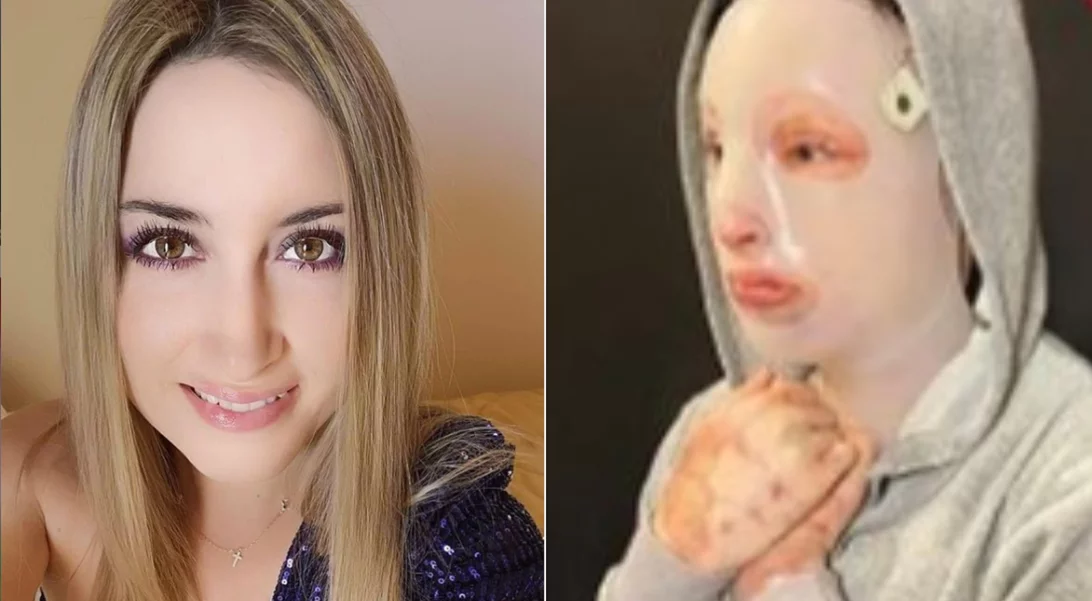 Ιωάννα Παλιοσπύρου | Το σχόλιο της Κατερίνας Καινούργιου κάτω από τη φωτογραφία της από το χειρουργείο