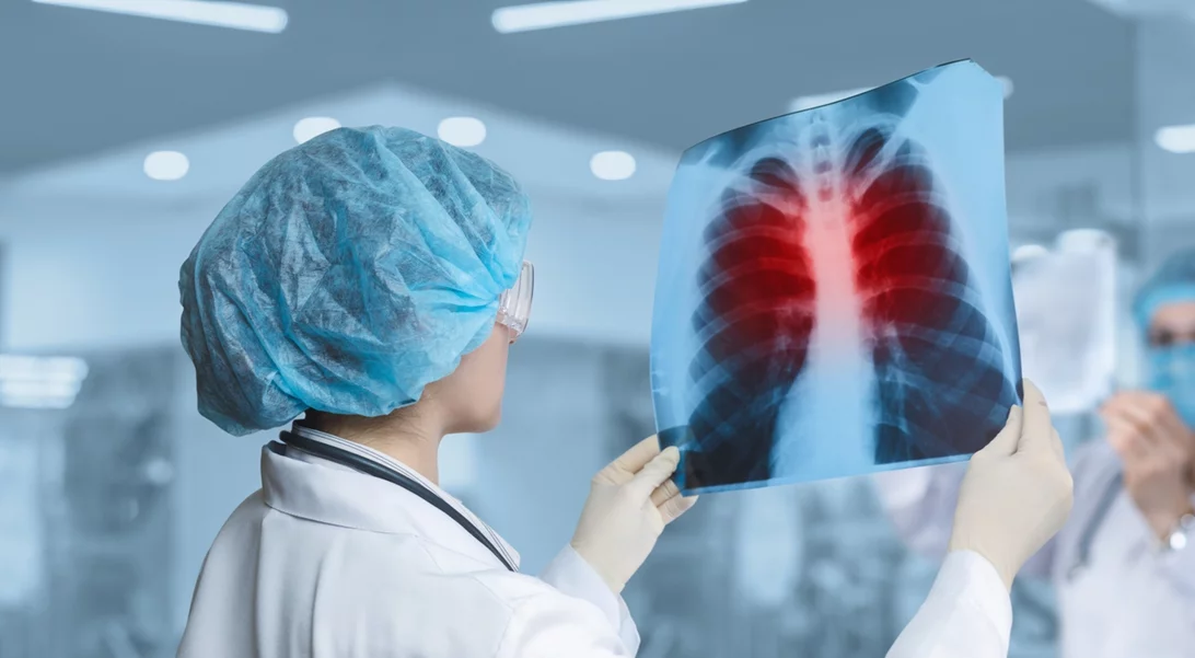 Έλληνες ερευνητές ενώνουν τις δυνάμεις τους για να λύσουν το γρίφο των σοβαρών λοιμώξεων του αναπνευστικού και των επιπλοκών τους