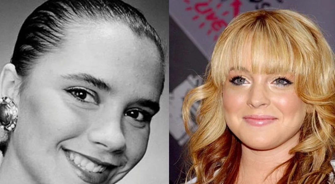 Πριν και μετά τις πλαστικές: Οι επώνυμοι που πλέον τρομάζουμε να αναγνωρίσουμε!