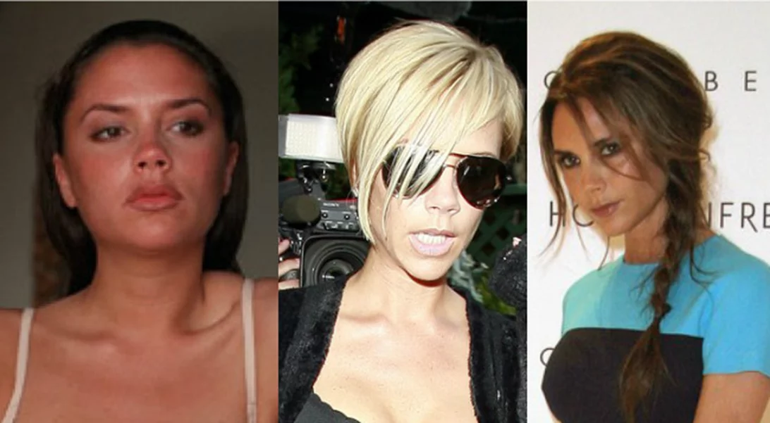 Το στήθος της Victoria Beckham έχει τη δική του προσωπικότητα και εξέλιξη στο χρόνο