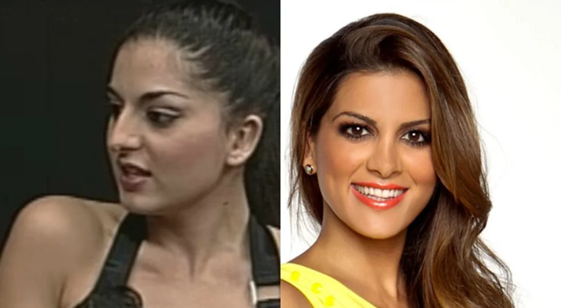 7+1 Ελληνίδες celebrities πριν και μετά την πλαστική μύτης