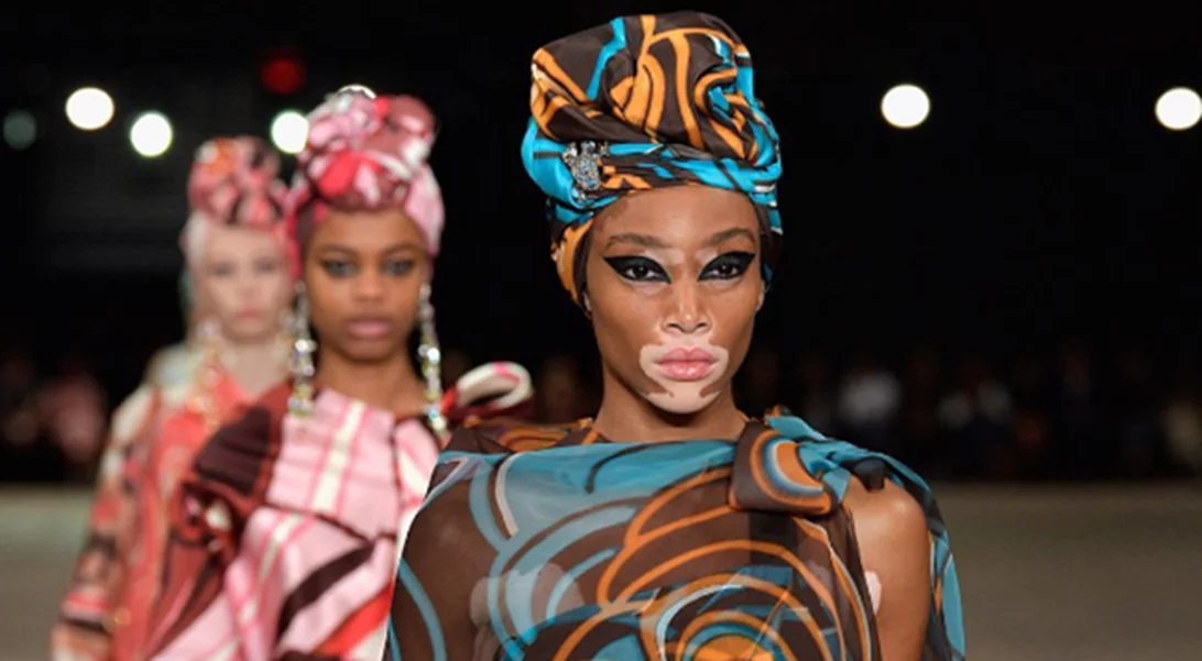 Winnie Harlow: Κι όμως δεν ήθελε να γίνει μοντέλο!
