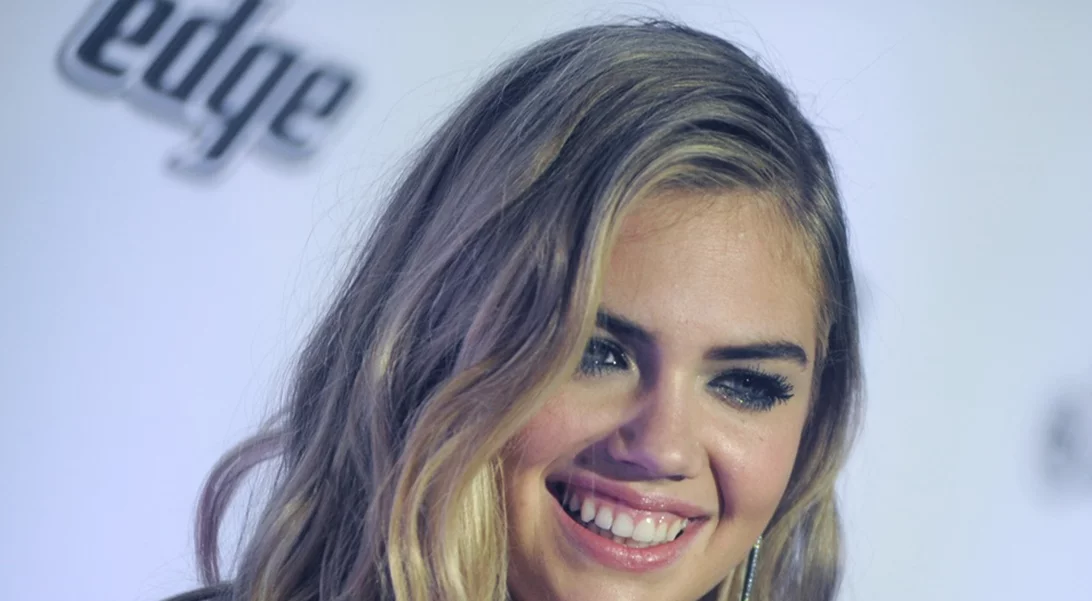 Kate Upton | Το σοκαριστικό ατύχημα της εν ώρα φωτογράφησης