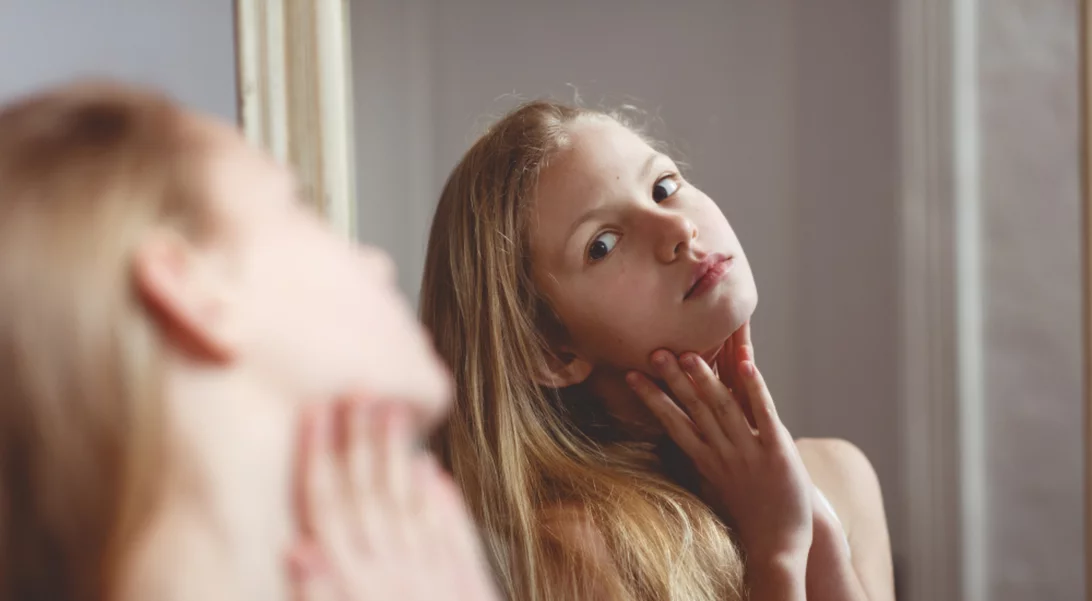 #Freethepimple | Ένα νέο κίνημα στο Instagram θα σε κάνει να αγαπήσεις την ακμή σου