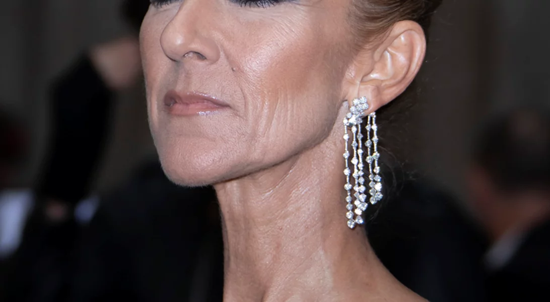 Celine Dion | Με μαύρο φόρεμα και διχτυωτές γόβες στιλέτο στους δρόμους του Παρισιού