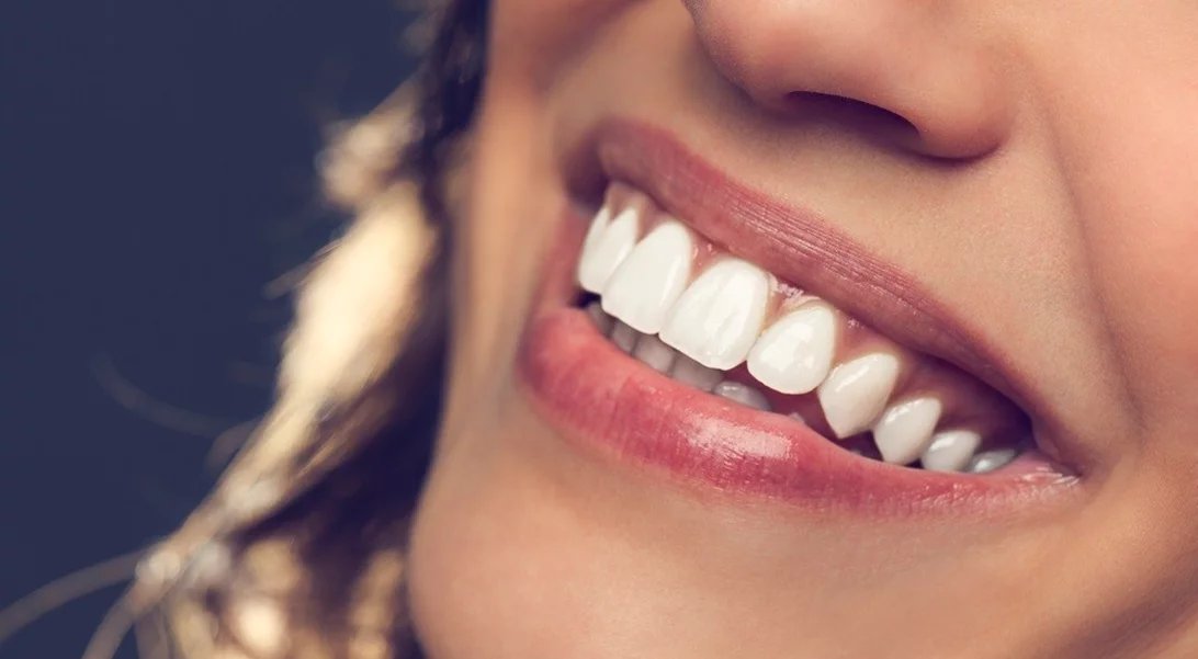 Ξέρουμε ακριβώς πώς θα αποκτήσεις το χαμόγελο που πάντα ονειρευόσουν