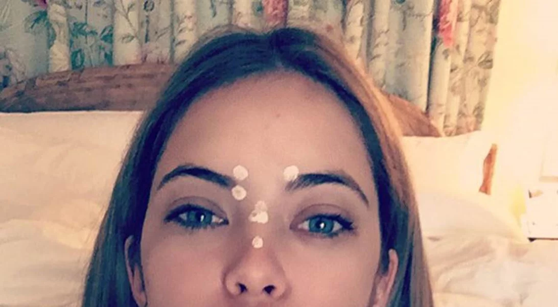 Δεν είσαι μόνη σου! 10 celebrities δείχνουν τα σπυράκια στο πρόσωπό τους